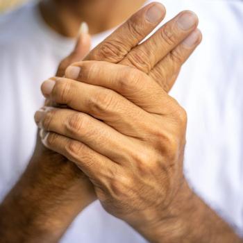 Secukinumab Retention, Efficacy, Safety Confirmed by Recent Interim Analysis | Image Credit: Adobe Stock