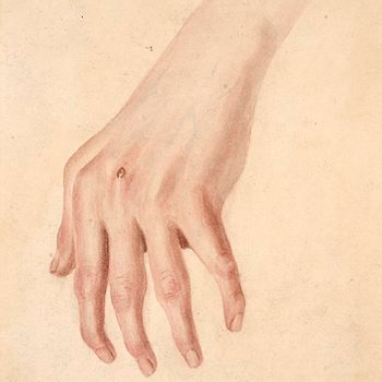 Methotrexate/Hydroxychloroquine Combo Beats MTX Alone in Rheumatoid Arthritis Treatment 