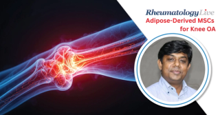 Adipose-Derived MSCs Show Promise as Nonsurgical Option for Knee OA, With Moshiur Rahman Khasru, MBBS, MSc