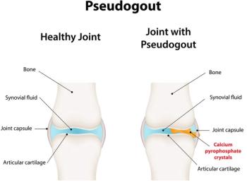 ©joshya/Shutterstock.com