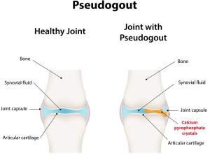 ©joshya/Shutterstock.com