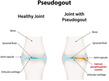 ©joshya/Shutterstock.com