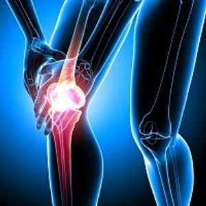 Knee Osteoarthritis Linked to Neuropathy