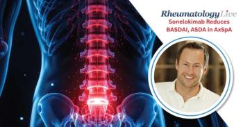 Sonelokimab Reduces Inflammation, Osteoblastic Activity in Phase 2 Proof-of-Concept axSpA Study