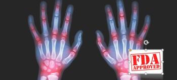 Tofacitinib Approved for Juvenile Arthritis