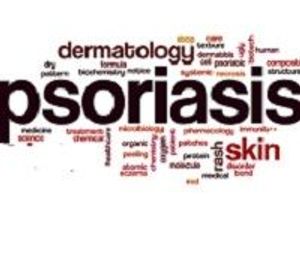 Psoriasis: Good News on Ixekizumab