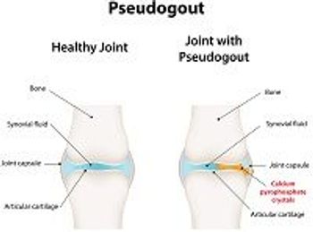 ©joshya/Shutterstock.com