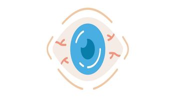The approval of tocilizumab for giant cell arteritis as a glucocorticoid-sparing