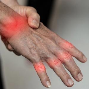 Study Finds Febuxostat More Hepatotoxic than Benzbromarone | Image Credit: Adobe Stock