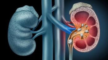 Dapagliflozin Earns Breakthrough Therapy Designation for Chronic Kidney Disease