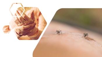 Q&A: Chronic Chikungunya Arthritis vs. Rheumatoid Arthritis