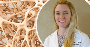 Study Finds Management of Glucocorticoid-Induced Osteoporosis Is Even Worse Than Feared