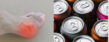 Studies Link Gout Flares to Consuming Sodas