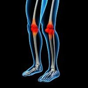 Study: Glucosamine and Chondroitin Supplements Show No Arthritic Benefit Over Placebo