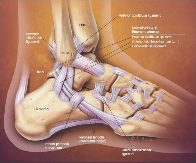 how-long-does-ankle-sprain-take-to-heal-launch-knowledge