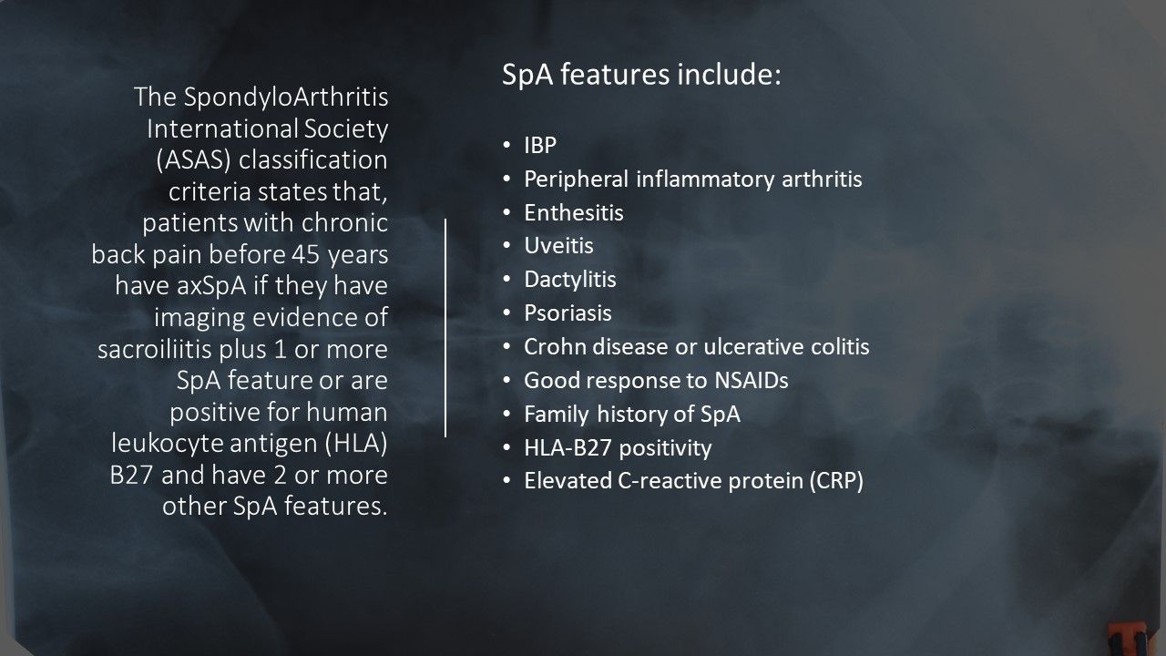 Recognizing Axial Spondyloarthritis in Primary Care 