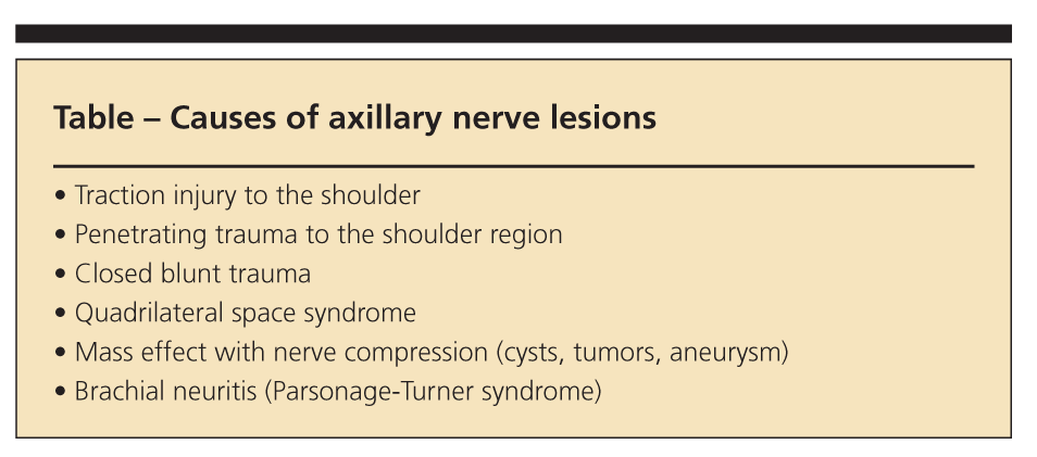 Diagnosis Of Isolated Axillary Neuropathy In Athletes Case Studies