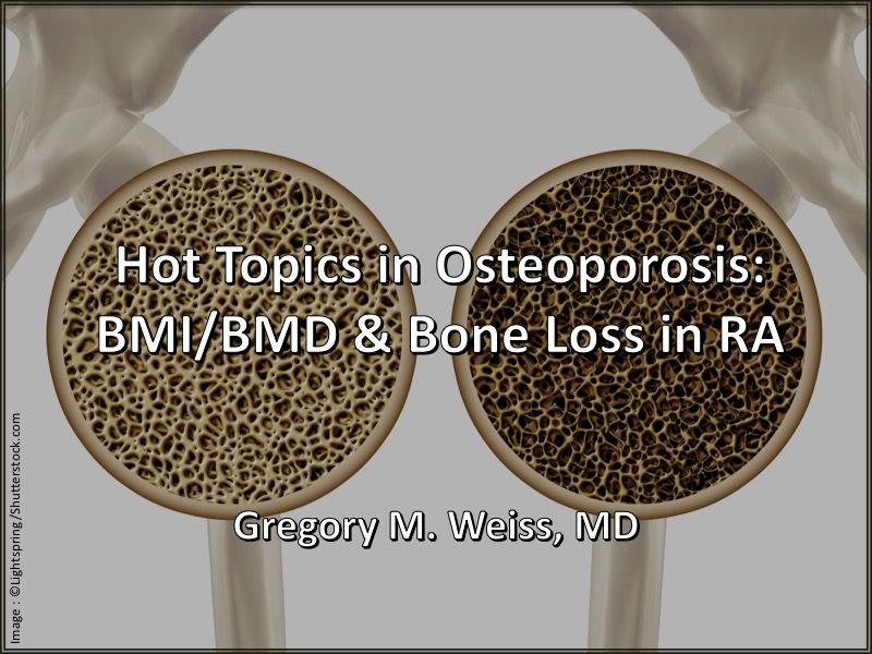 Hot Topics In Osteoporosis Bmi Bmd Bone Loss In Ra Rheumatology Network