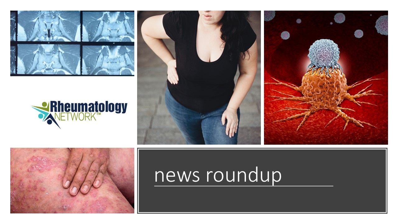 Rheumatology News Roundup: Methotrexate-Skin Cancer Rates
