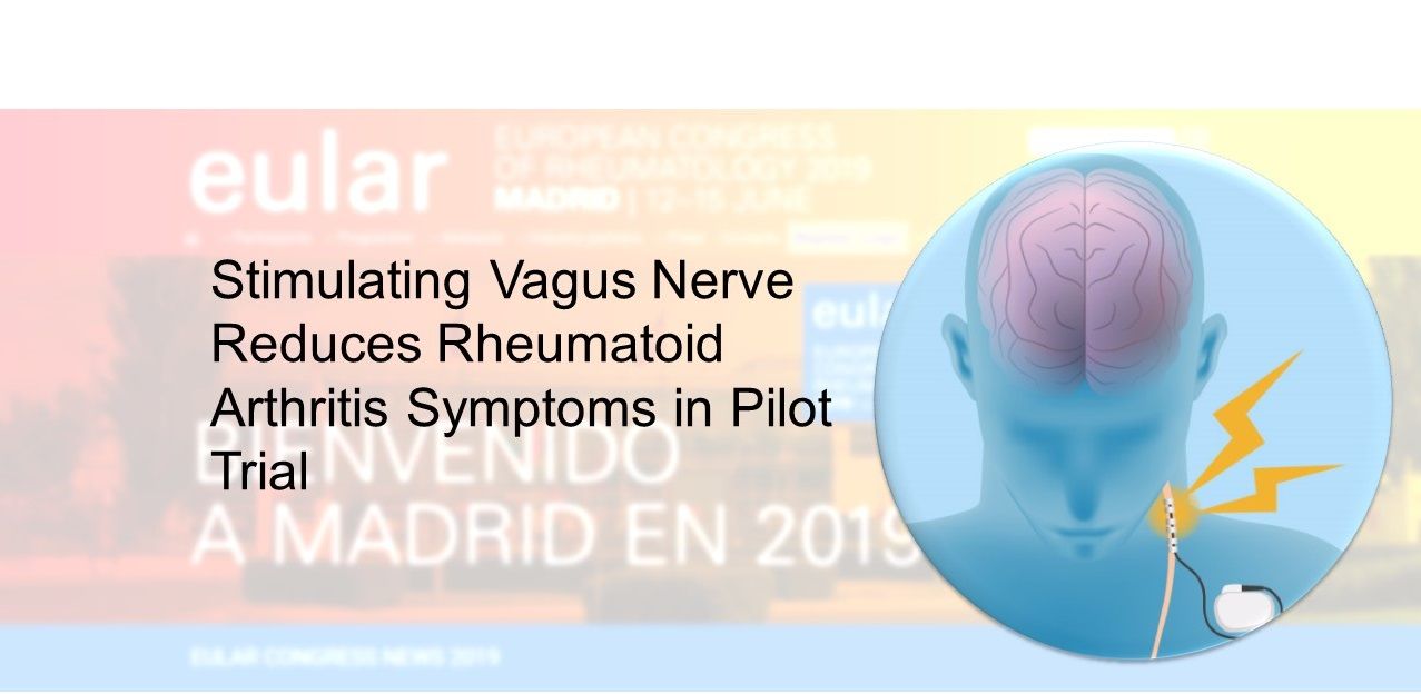 Stimulating Vagus Nerve Proves to Reduce Rheumatoid Arthritis Symptoms