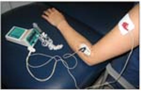 Iontophoretic Administration Of Dexamethasone For Musculoskeletal Pain