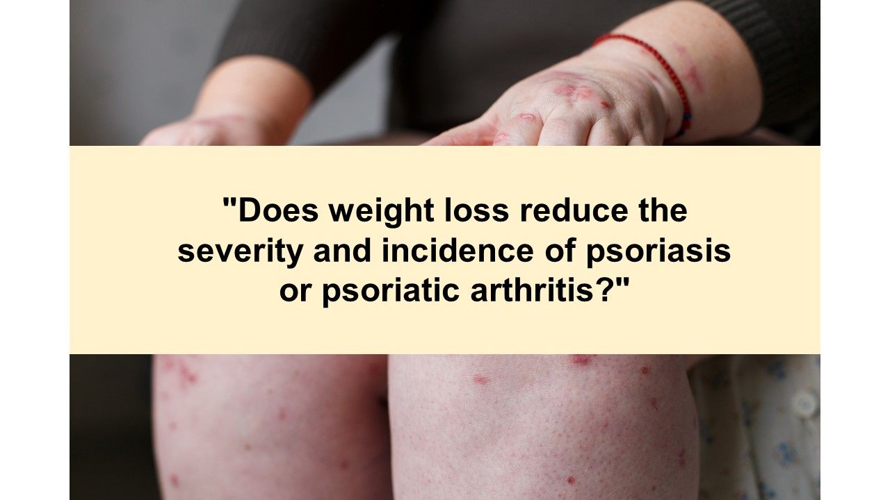 Psoriatic Arthritis Health Quiz Is it axial PsA or AS? Rheumatology