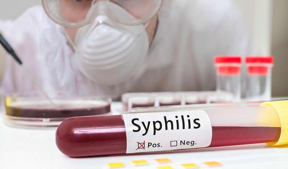 Syphilis False Positives in SLE and Lupus Nephritis