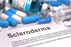 Case Study:  Scleroderma sin Scleroderma