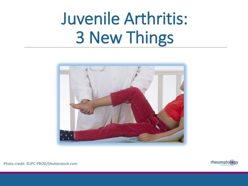 Juvenile Arthritis 3 New Things Rheumatology Network