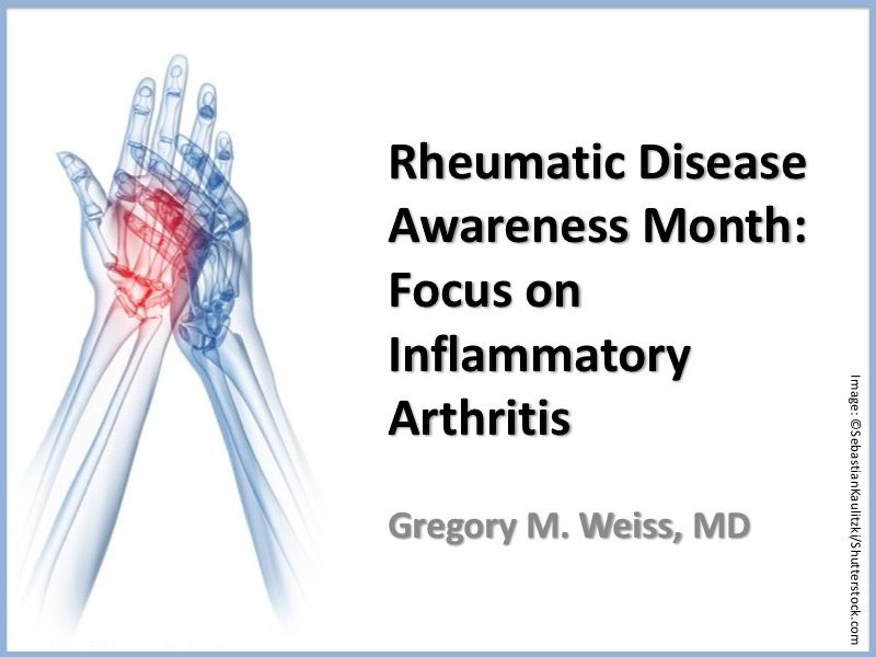 inflammatory arthritis
