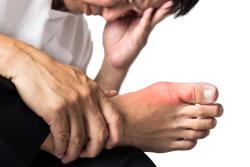 Metabolic Syndrome Identified Among Risk Factors for Early Onset Gout in Men 