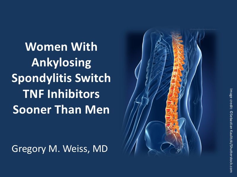 Women With Ankylosing Spondylitis Switch Drugs Sooner Than