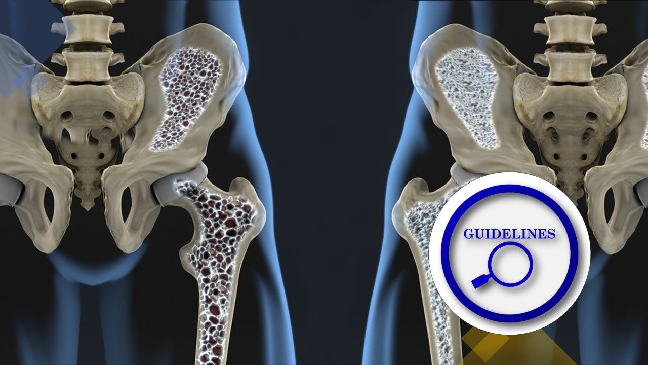 Guideline Update Romosozumab in Osteoporosis