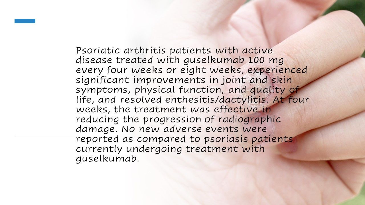 psoriatic arthritis treatment