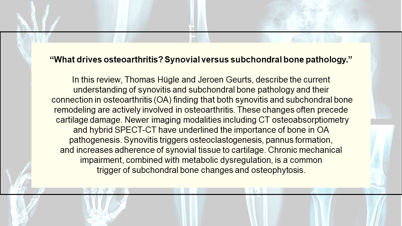 10 Most Cited Studies from the Journal Rheumatology Begins with Lupus