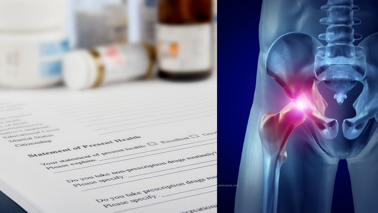 Managing Rheumatic Medications after Hip or Knee Surgery