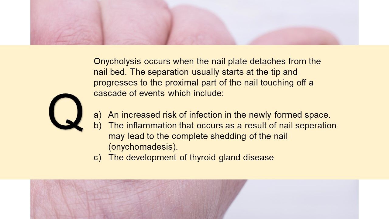 PsA Quiz Nail Pitting and Onycholysis Rheumatology Network