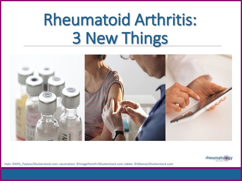 Rheumatoid Arthritis 3 New Things Rheumatology Network