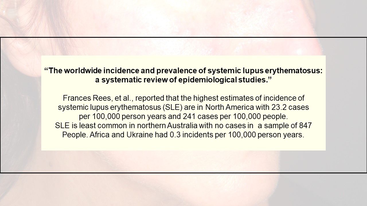 10 Most Cited Studies from the Journal Rheumatology Begins with Lupus