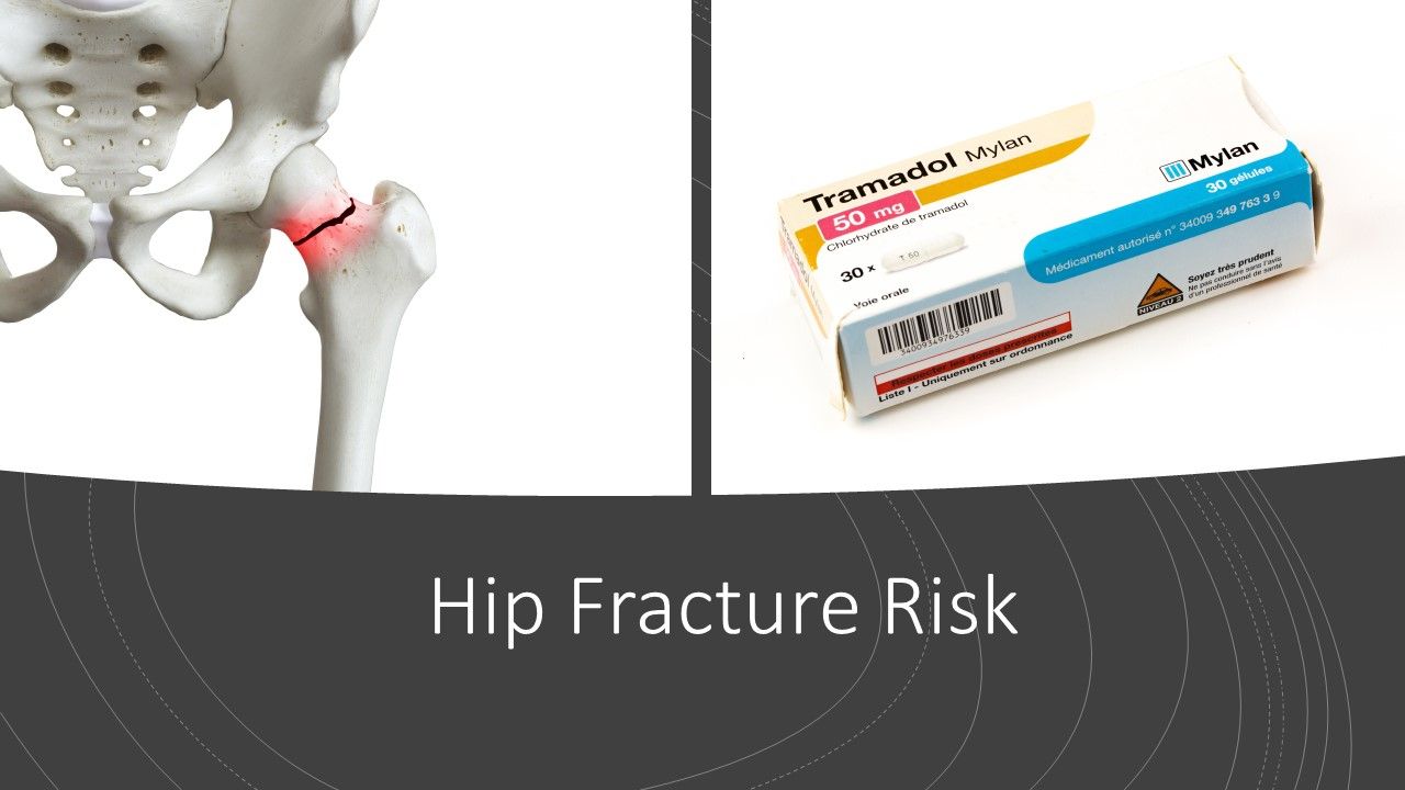 Hip Fracture Risk Increases With Tramadol Hip Fracture Risk Increases With Tramadol