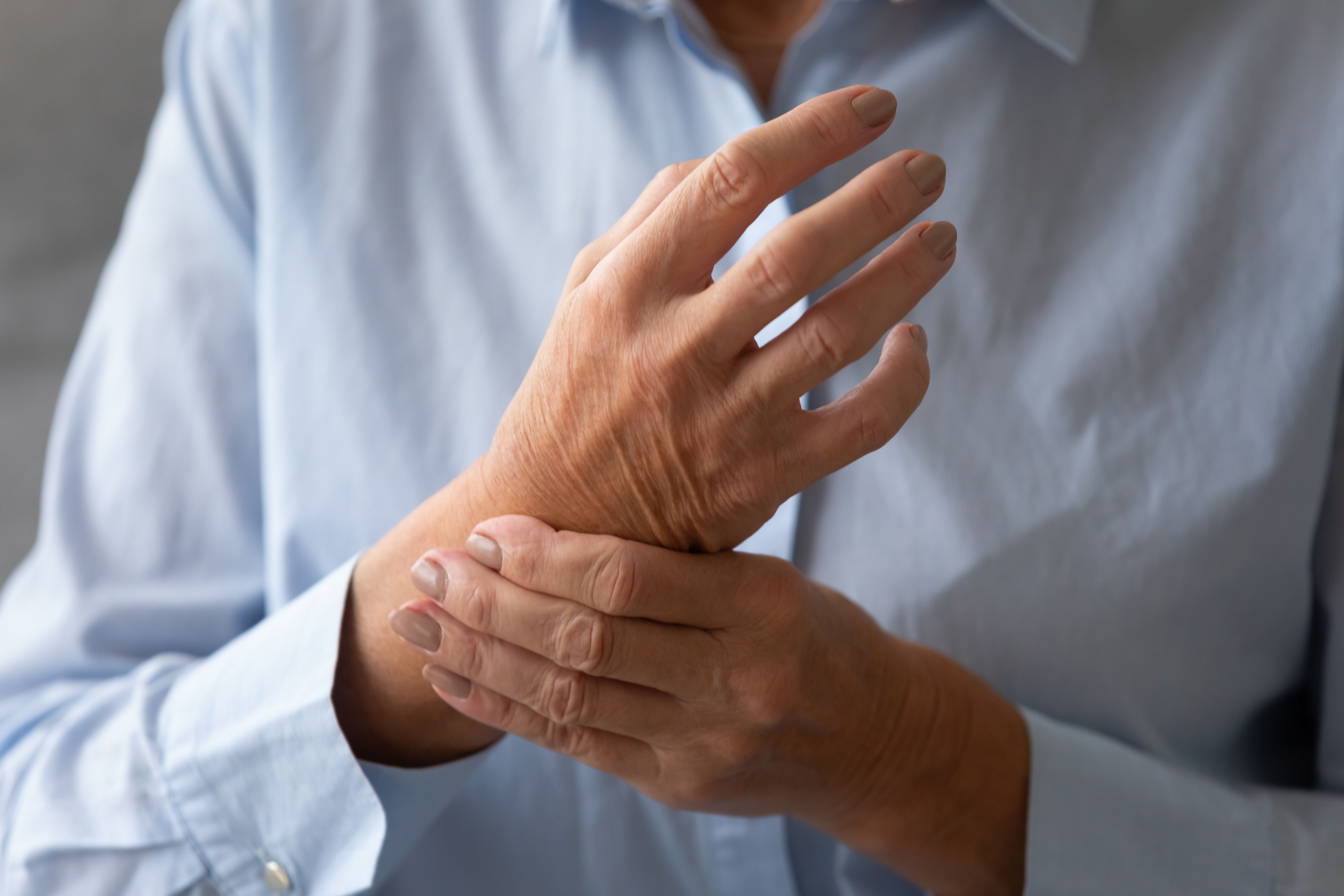 QUIZ Diagnosis and Treatment of Early Rheumatoid Arthritis
