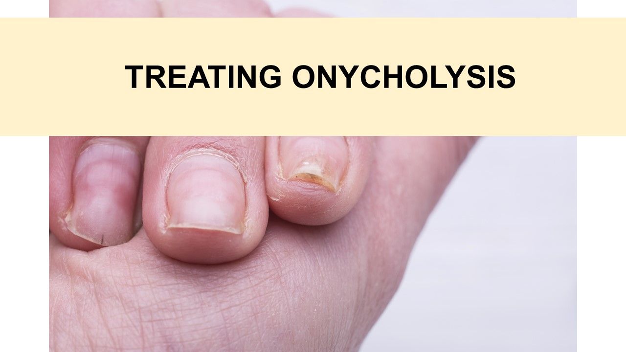 PsA Quiz Nail Pitting and Onycholysis Rheumatology Network