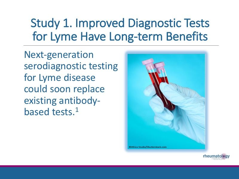 Lyme Arthritis 3 Things to Know Rheumatology Network