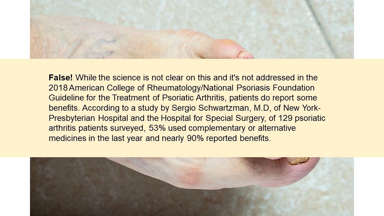 Psoriatic Arthritis Quiz Monotherapy, Complimentary Medicine and Joint