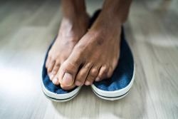Prevalence of Gout Reportedly Higher in Black Patients  