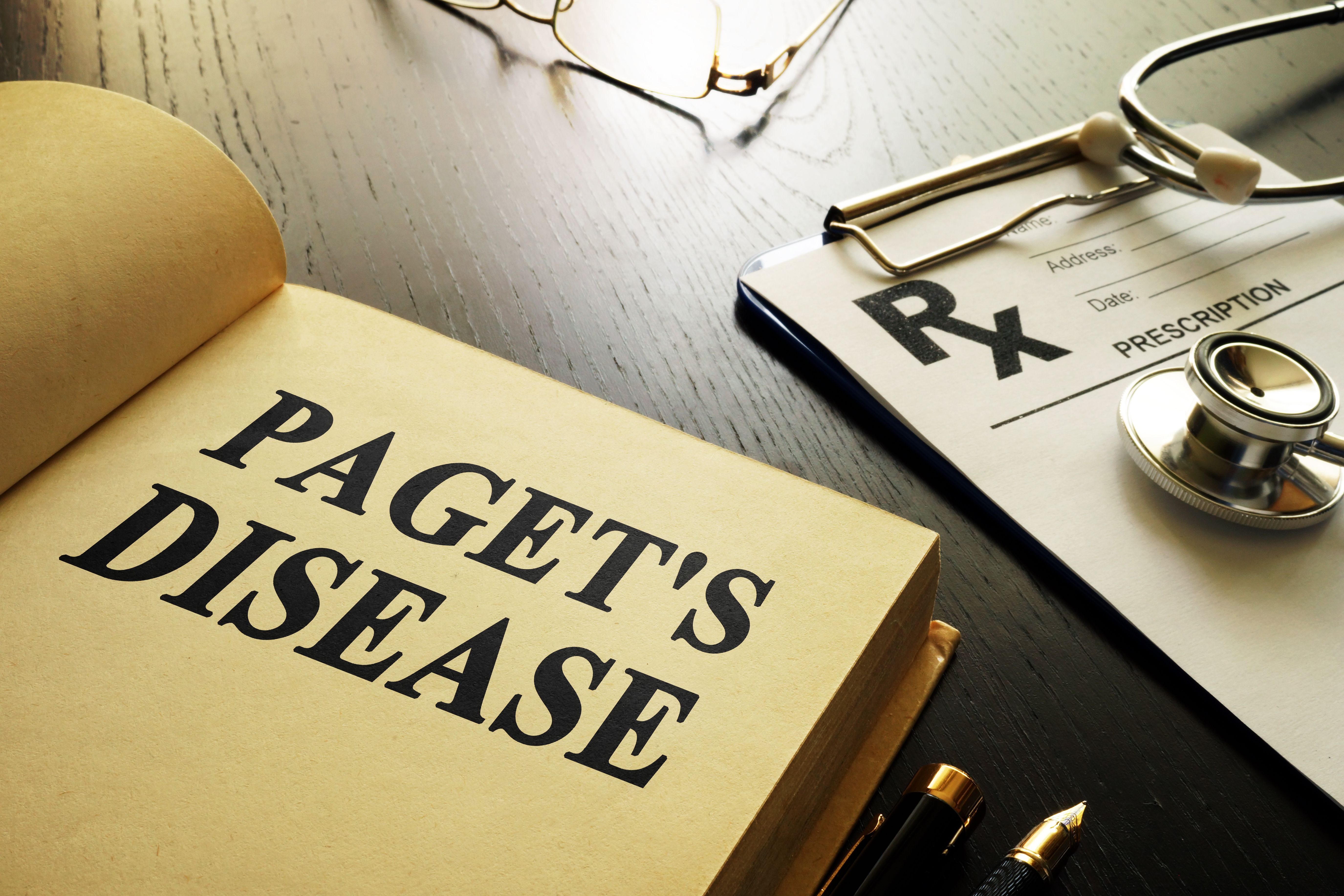 New for Treatment of Paget’s Disease Released