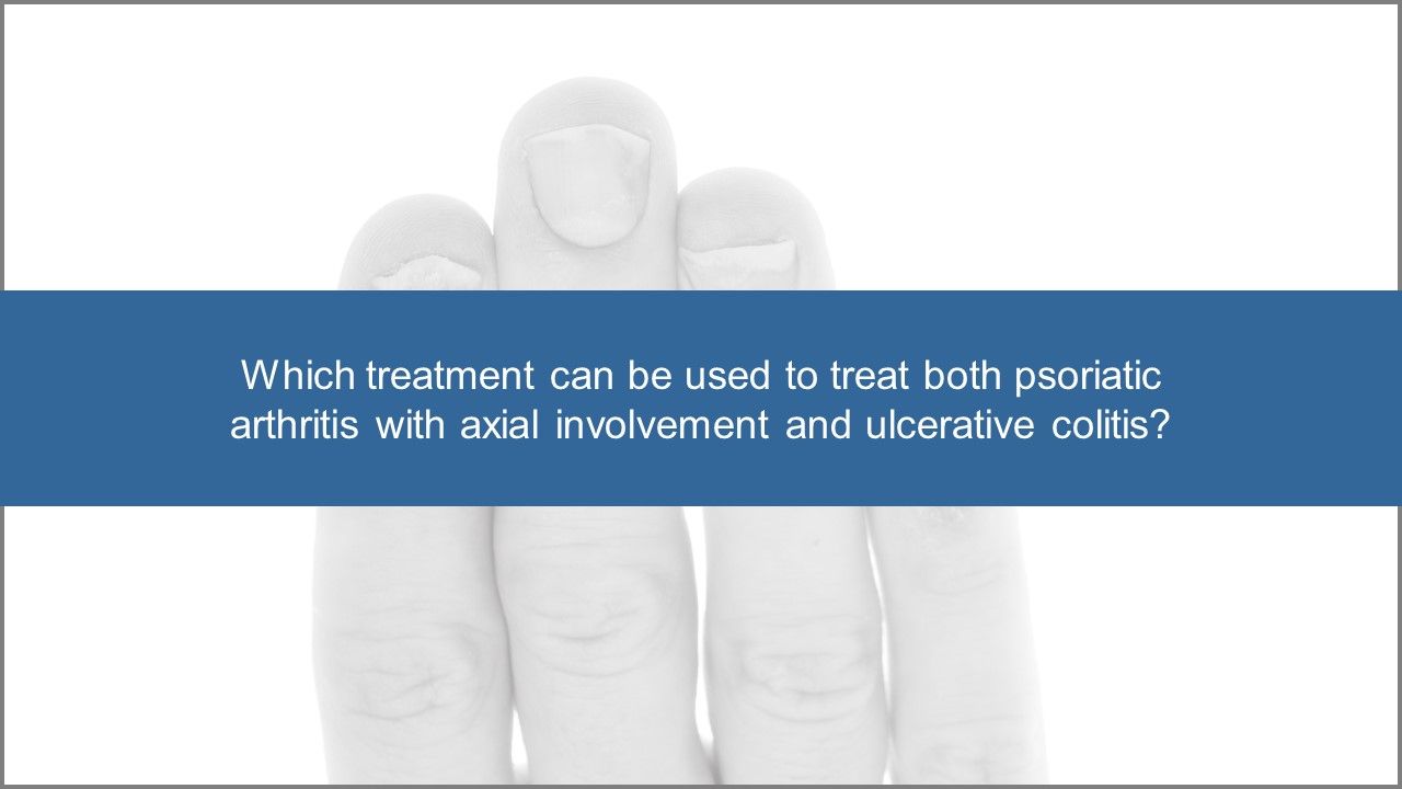 Psoriatic Arthrits Quiz:  Treatment Options