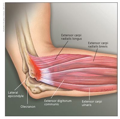 icd 10 code soft tissuemass of elbow