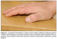 Limited Joint Mobility In Diabetes Mellitus The Clinical Implications Limited Joint Mobility In Diabetes Mellitus The Clinical Implications