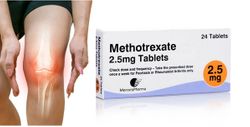 Methotrexate Reduces Knee Inflammation in Primary Knee Osteoarthritis